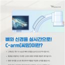 서울시원한마취통증의학과의원 | 씨암주사 c-arm 원리와 주사치료 후 주의사항은