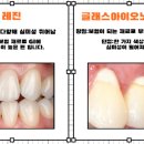 3day치과기공소 이미지