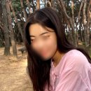 (통증,부작용없었어요!) 수원 인계동 피부과 세모아의원 리쥬비엘 이마필러 4cc