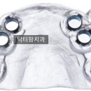 이로치과기공소 이미지