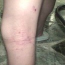 아토윌사랑한의원 이미지