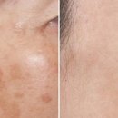 프리뷰티셀플라 이미지