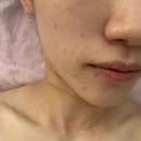 달구벌약국 | 대구 수성구에스테틱 시지 피부관리잘하는곳 이지셀스킨 후기