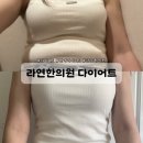 강남 다이어트 한의원 여름맞이 체중감량 뉴빼빼환 도전 찐 후기