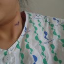 장수헬스사우나 | 아주대병원 갑상선, 난소낭종 협진수술후기 회복증상 후기