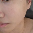 [천안에스테틱] 돌업뷰티에스테틱 자극없는 윤곽관리 후기