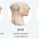 라인카이로프랙틱
