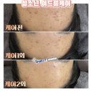 필메디칼 이미지