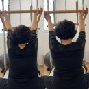 오창한의원 | [공지] 오창 재활필라테스 재활운동, 2주만에 이렇게나 변했다니? B&amp;A (허리디스크, 거북목)