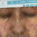 엄제이코칭연구소 | 창원 상남동 피부관리 에스테틱 예민 트러블 르네아 바이더랩