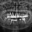 열린오치과의원 이미지