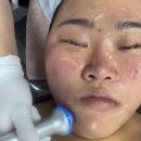 [부천상동 피부관리 후기] 위드왁싱앤뷰티에서 라라필 + 스킨플래닝 받고 피부가 환해졌어요!