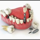 일산스마트치과의원 이미지