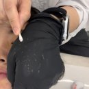 여드름 피부관리 미더베스트 홍대점 유황 재생관리 내돈내산 후기