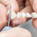 공감치과기공소 이미지