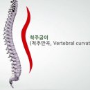 후유 이미지