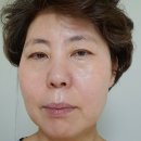 비포런스