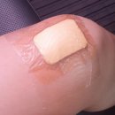 늘봄미아름의원 | [제주시 월랑로 피부과] 늘봄미아름의원 - 화상치료