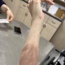 두손병원 앞 인도 | 또 심재성 2도 화상.. 대구푸른병원 대구에스병원 비교후기 입원