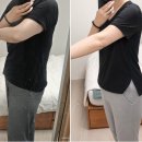 멍이와 양이 | 종로 피부과 명동 지방분해주사 칼로핏주사 팔뚝 솔직후기