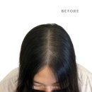 리빈 | 감추는 것보다 자연스럽게, 리빈스칼프 가르마 두피커버 후기