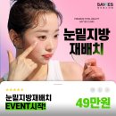 일바 - 수원시 팔달구 효원로249번길 46-19 | 강남역 눈밑지방재배치 비용 49만원 후기, 눈밑지방레이저 방식으로 하면 재발하는 이유