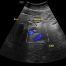 한양내과의원 | 위염약만.. 먹는거 피해서 체중은 빠지고... - 동대문구 답십리, 전농동, 우리안애 우리안愛 내과