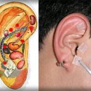 이혈요법 이미지