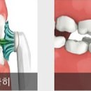 NY단치과 이미지