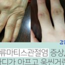 양산우리편한내과의원 네이버블로그