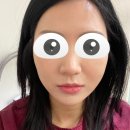 명한의원 | [청담동한의원] 안면비대칭 1회 침 맞은 후기