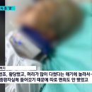 킥보드 단속하다 뇌출혈...경찰 과잉 단속 논란 이미지