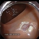 서울드림내과의원 네이버블로그