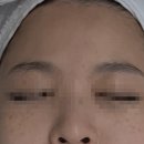 오혜림스킨케어