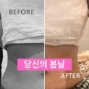 조마루로1L | 당신의봄날 부천점, 부천바디관리로 찾은 가벼운 라인 변화 후기
