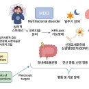 우울증 이미지