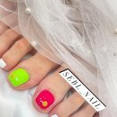 서은 | 금오동 발톱무좀 서은뷰티랩에서 치료 후기