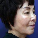 리뉴미피부과 이미지