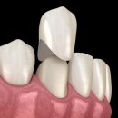 본치과기공소 이미지