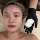 서초동 압출 잘하는 곳 - 강남 신논현 ‘윈터에스테틱’ 여드름 압출 후기 (!압출, 피지 사진 주의!)