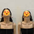 박솔빈 | [강남 수페이스] 안면 비대칭 턱관절 관리 전문 1:1 맞춤 케어 후기