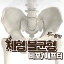 체형교정 비포 애프터 #대전 문화동 헬스 #문화동 헬스 #문화동 pt #문화동교정