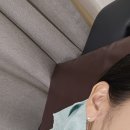 귀 옆 안 짜지는 여드름 수술 후기 (피부과 말고 외과에서 제거한 솔직 후기)