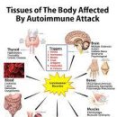 자가면역질환 이미지