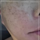 에스알뷰티케어 이미지