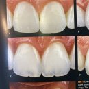 가지런e치과기공소 이미지