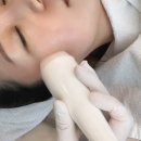 일산 에스테틱 대화동 피부관리 알엔뷰티랩 익셉션 필링 추천 (ft. 대학병원 간호사/피부미용과)
