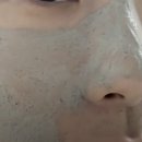 미라클케어 이미지