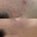 블루에그 이미지