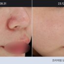 세종스노우의원 네이버블로그